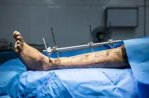 Musculoskeletal-Orthopedics & Spine