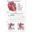 Sinus Arrest