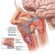 Olfactory Dysfunction