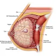Breast cyst aspiration