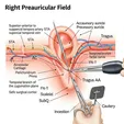 Auricular Tag Excision