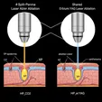 CO₂/Er:YAG Laser Ablation