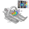 Intensity-Modulated Radiation Therapy (IMRT/VMAT/IGRT)