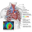 Atrial Tachycardia Catheter Ablation