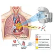 Chemoradiotherapy (Perioperative/Concurrent Chemoradiation)