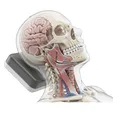 Intensity-Modulated Radiation Therapy (IMRT)