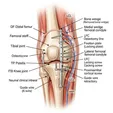 Distal Femoral Osteotomy (DFO, Internal Fixation)