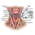 Partial Thyroidectomy (Endoscopic/Robotic)