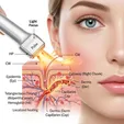 Intense Pulsed Light (IPL)