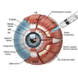 Extraocular Muscle Botulinum Toxin Type A Injection