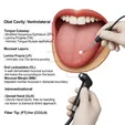 CO₂ Laser Ablation
