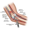 Elbow Arthroscopy/Extensor Tendon Repair
