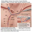 Endoscopic Electrocoagulation/Chemical Ablation + Bioglue Occlusion