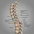 Posterior Corrective Fusion + Internal Fixation