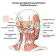 Occipital Nerve Block