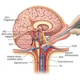 Microvascular Decompression (MVD)