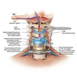 Anterior Cervical Discectomy and Fusion (ACDF)