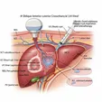 Aspiration ± Sclerotherapy/Steroids
