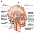 Bone-Anchored Hearing Aid (BAHA/Bonebridge)