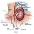 Image-guided Aspiration + Sclerotherapy