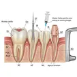 Microscopic RCT