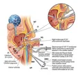 Functional Endoscopic Sinus Surgery (FESS)