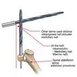 Canalplasty/Meatoplasty (Microscopic/Endoscopic, Flap/Graft)
