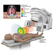 Intensity-Modulated Radiation Therapy (IMRT/VMAT, IGRT)