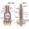 Anterior-Posterior Combined Correction and Fusion (Severe/Rigid)