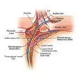 Regional Lymph Node Dissection