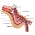 Axillary Microwave Ablation