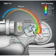 Intensity-Modulated Radiation Therapy (IMRT/VMAT)
