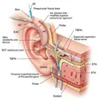 Preauricular Sinus Excision