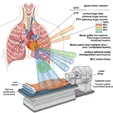 Stereotactic Body Radiation Therapy (SBRT)