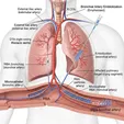 Bronchial Artery Embolization