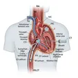 Typical Atrial Flutter Isthmus Ablation (CTI)