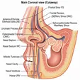 Balloon Sinuplasty