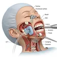 Multiple Tooth Comprehensive Restoration